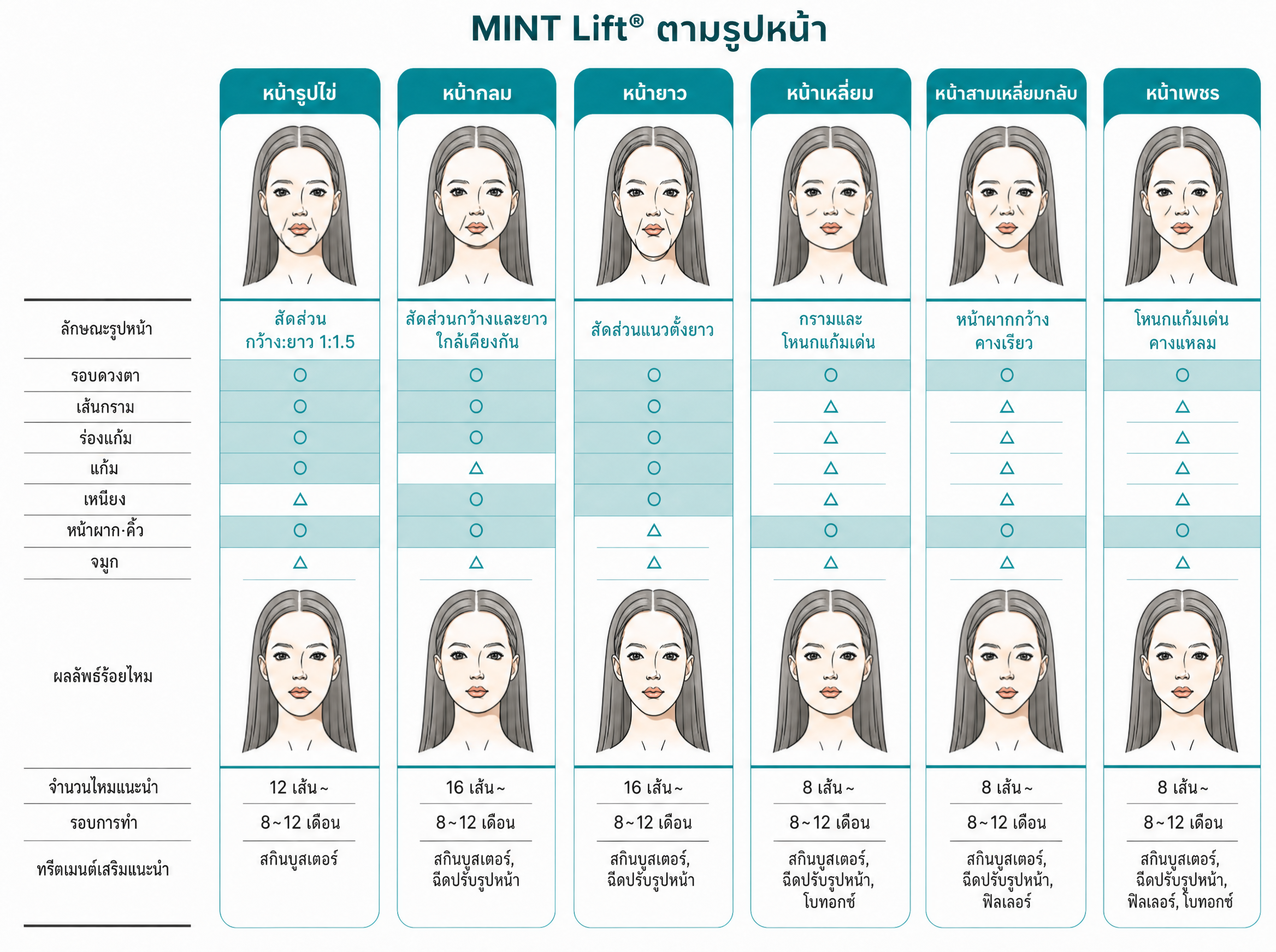 หลักการร้อยไหม MINT Lift และ epiticon